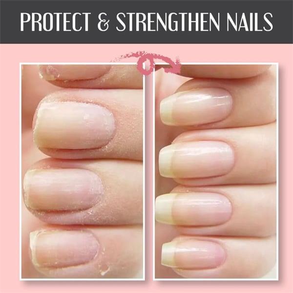 2023 Schutzgel für Nagelreparatur kaufen 2 Holen Sie sich 1 kostenlos