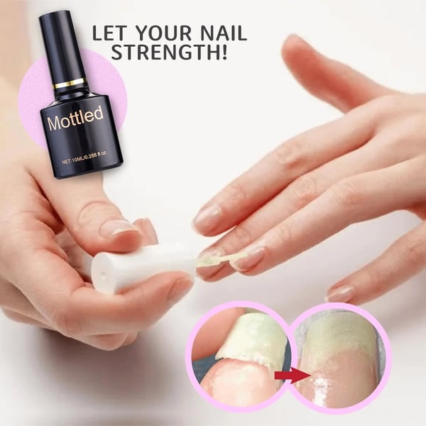 2023 Schutzgel für Nagelreparatur kaufen 2 Holen Sie sich 1 kostenlos
