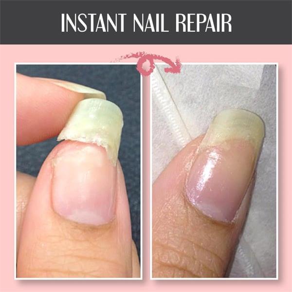 2023 Schutzgel für Nagelreparatur kaufen 2 Holen Sie sich 1 kostenlos