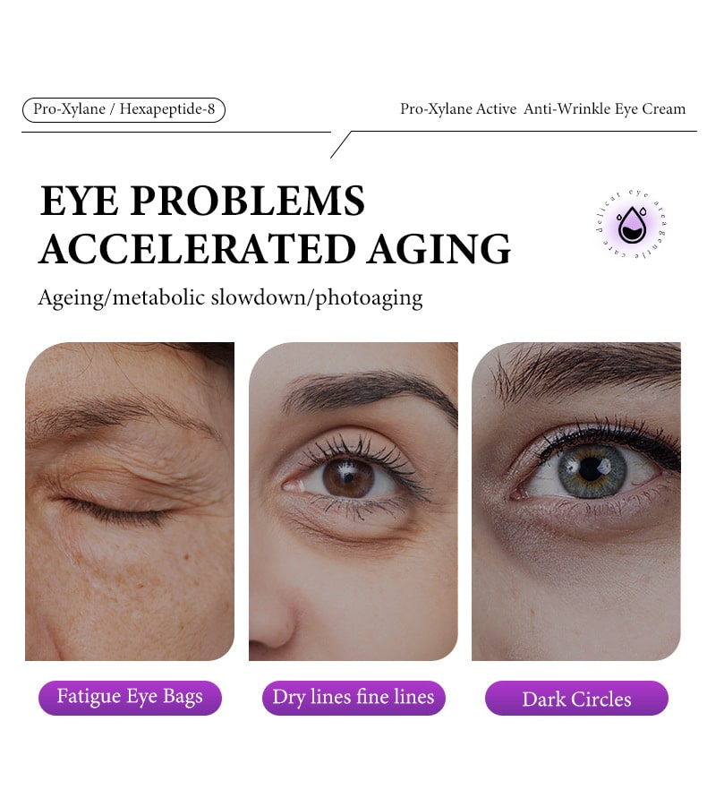 👀Verbessert Schwellungen, Augenringe und hilft Ihnen, Augenfalten zu kaschieren🤩