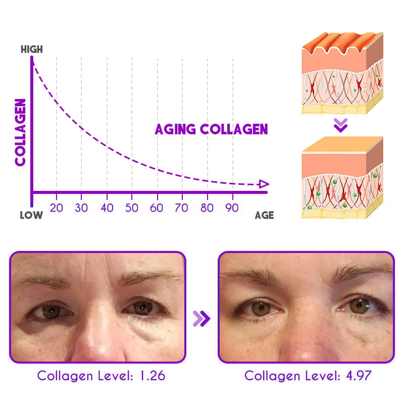 👀Verbessert Schwellungen, Augenringe und hilft Ihnen, Augenfalten zu kaschieren🤩